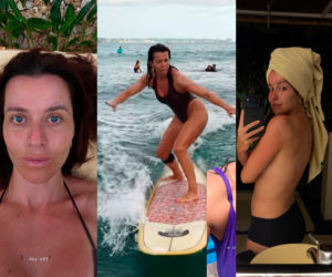 Gwiazda TVN miała poważny wypadek na wakacjach. Jej twarz jest zrujnowana!