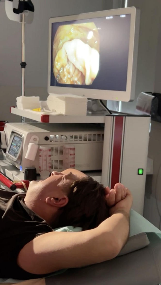 Lekarz zrobił sobie kolonoskopię na żywo