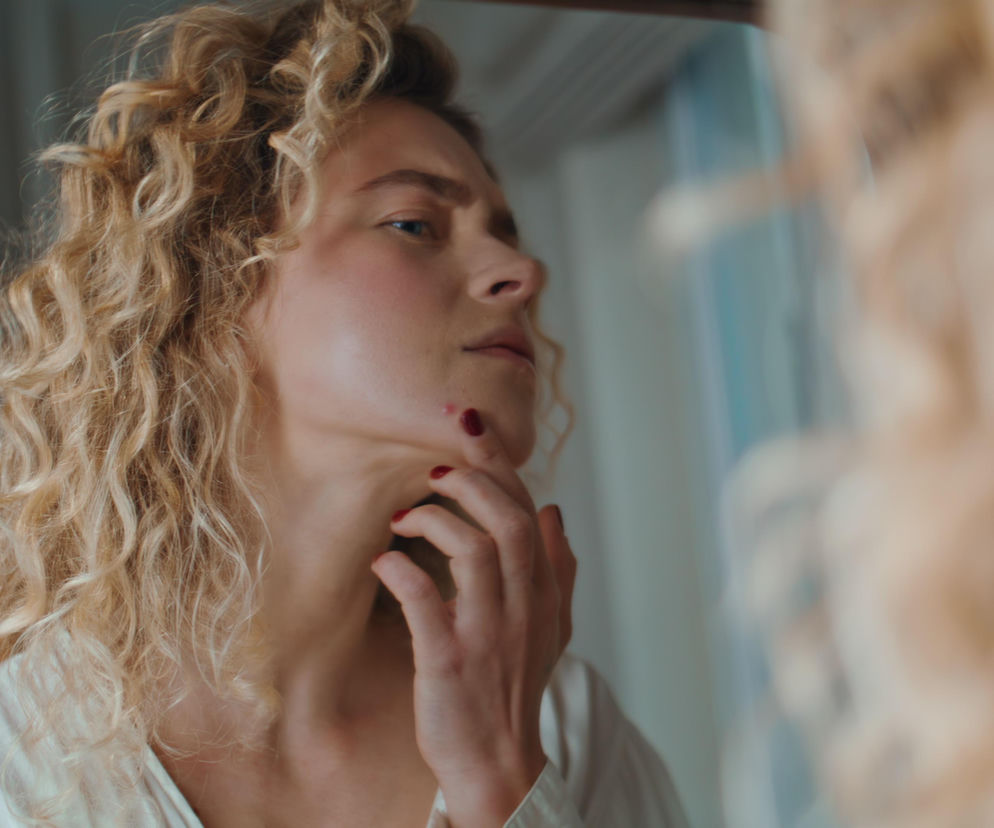 Masz problemy z trądzikiem? Winne mogą być ... jelita. Sprawdź, co naprawdę szkodzi twojej cerze