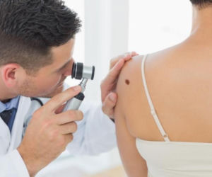 Czerniak diagnozowany coraz częściej. NFZ apeluje o profilaktykę