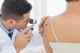 Czerniak diagnozowany coraz częściej. NFZ apeluje o profilaktykę