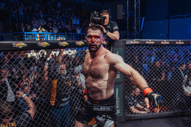 Tak wyglądała twarz Szymona Kołeckiego po zdobyciu pasa mistrza Babilon MMA. Krew zalewała mu twarz
