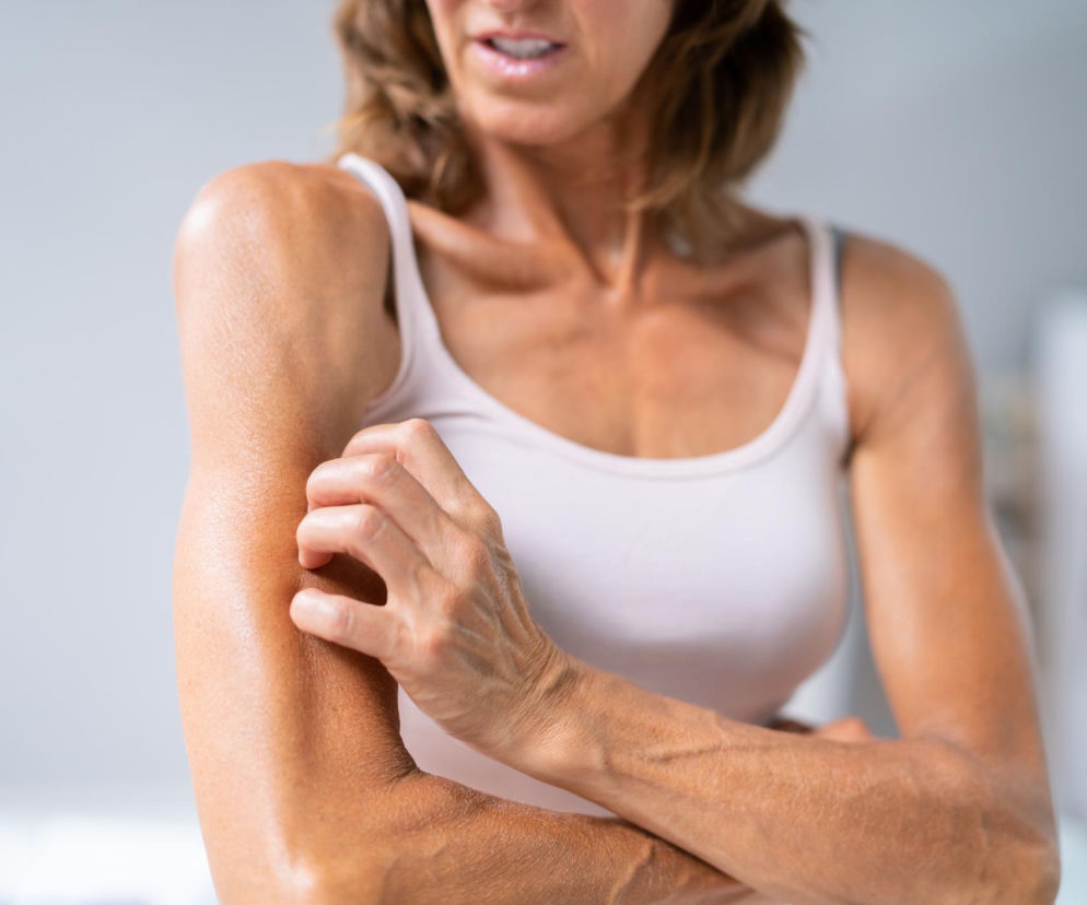 Twoja skóra swędzi po treningu? To nie tylko pot. Poznaj prosty sposób na natychmiastową ulgę