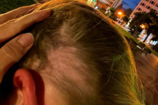 Siedlce: 13-letnia Ukrainka została zaatakowana przez 41-letnią Polkę