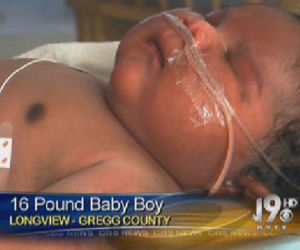 Noworodek ważący prawie 8 kg