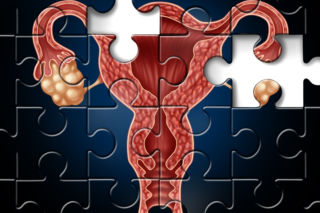 Menopauza - w jakim wieku występuje? Objawy przekwitania