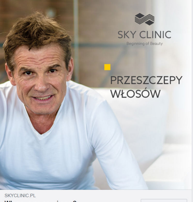 Marek Włodarczyk przeszczepił włosy