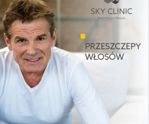 Marek Włodarczyk przeszczepił włosy