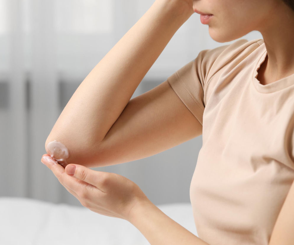 Szorstkie łokcie i ciemne kolana? Zapomnij o drogich kremach. W kuchni znajdziesz lepsze rozwiązanie