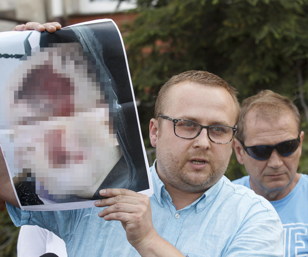 Lubin. Konferencja prasowa rodziny zmarłego Bartosza S.