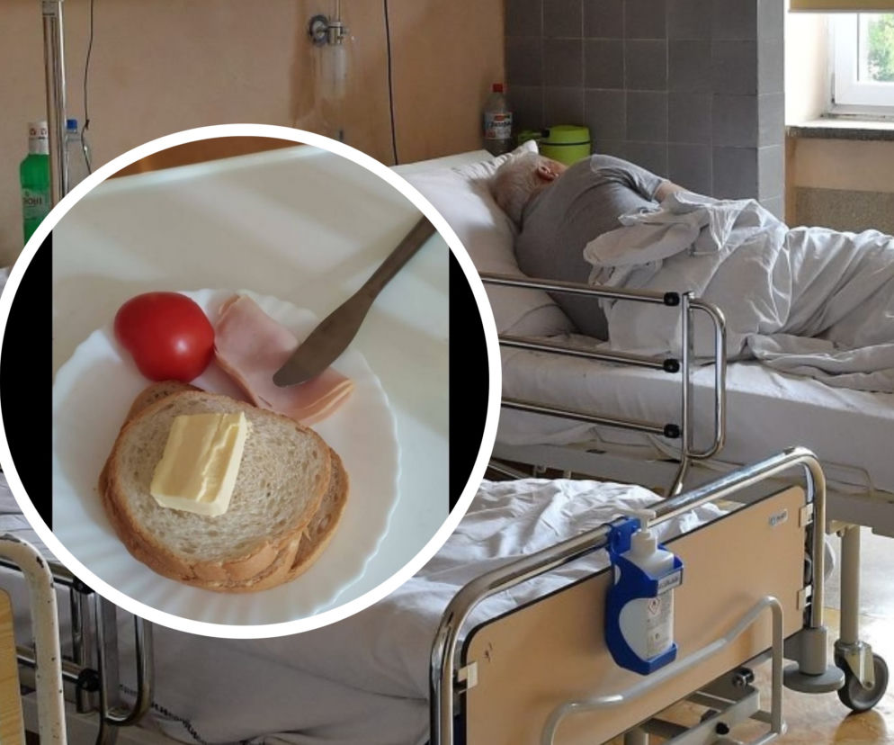 Szok! Tak karmią w Polskich szpitalach! Zobacz, co ląduje na talerzach pacjentów 
