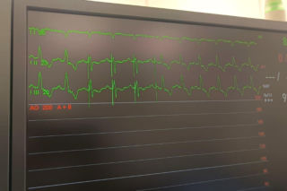 Kolejny sukces lekarzy z Gliwic. Wszczepili pacjentowi nowoczesny rozrusznik serca