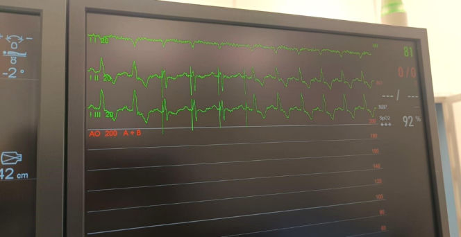 Kolejny sukces lekarzy z Gliwic. Wszczepili pacjentowi nowoczesny rozrusznik serca