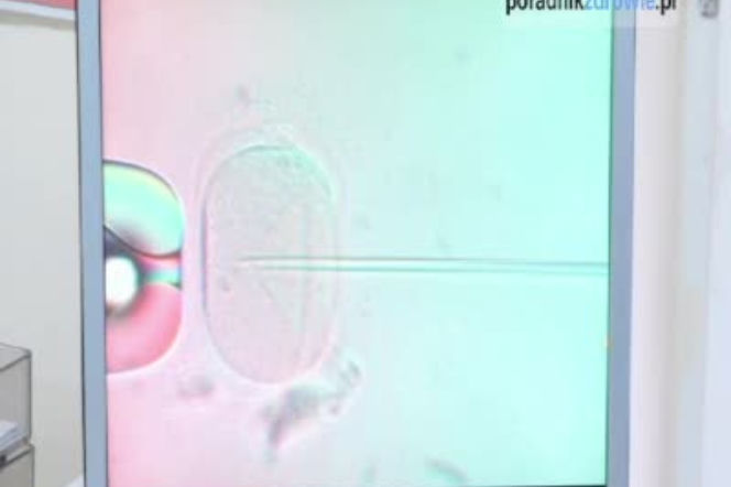 Wskazania do in vitro