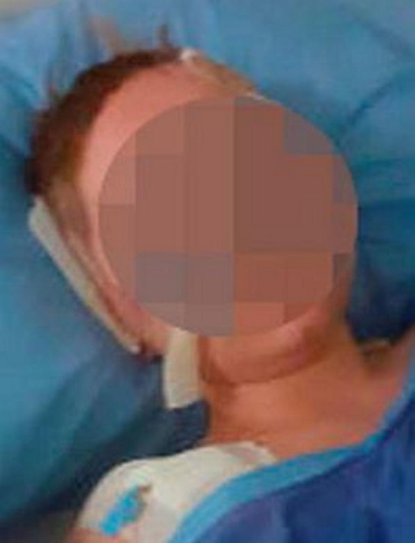 Koszmarny wypadek na wakacjach w Egipcie! Paulina straciła rękę [ZDJĘCIA]