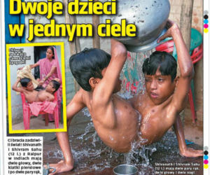 Dwoje dzieci w jednym ciele