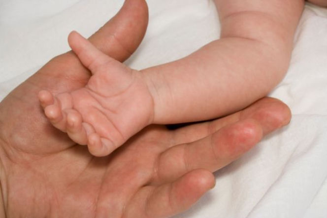 Talasemia (niedokrwistość tarczowatokrwinkowa): α-talasemia, β-talasemia, niedokrwistość Cooleya