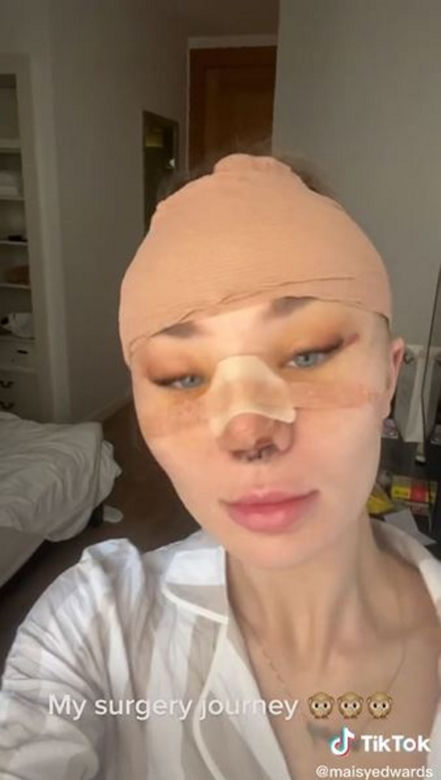 Znana influencerka pojechała do Turcji "zrobić" sobie nos. Wydała 50 tys. zł, fani bezlitośni: "Jest gorzej"