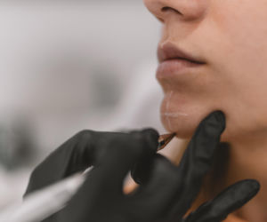 Koniec z efektem maski. Ta innowacyjna metoda siatki wygładzi twoje czoło i zachowa naturalny uśmiech