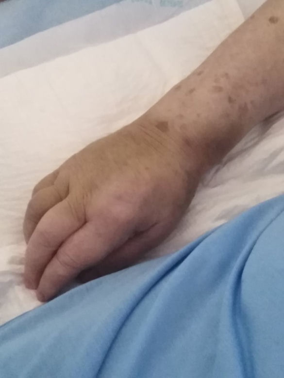 Szpital pomylił pacjentów?