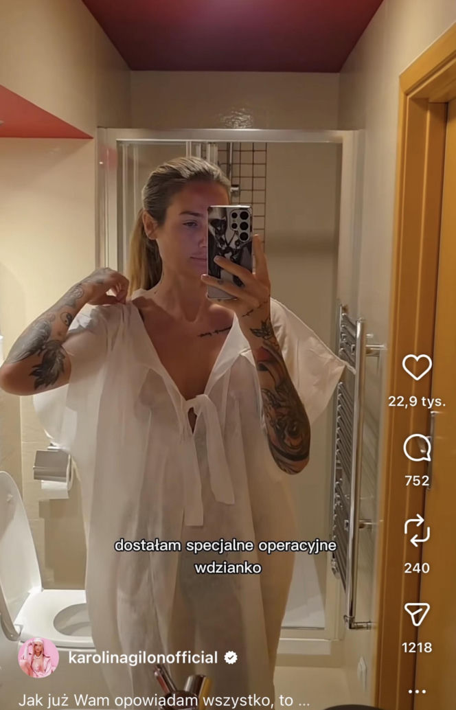 Karolina Gilon zoperowała biust. Zdjęcia przed i po