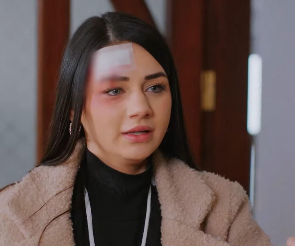 Młoda kobieta, Bahar, z widocznymi obrażeniami na twarzy – plaster na czole, podbite oko – w beżowym futerku i czarnym golfie, stoi w wejściu do domu. Ta scena to część intrygi z serialu „Miłość i nadzieja”, o której więcej przeczytasz na portalu Super Seriale.