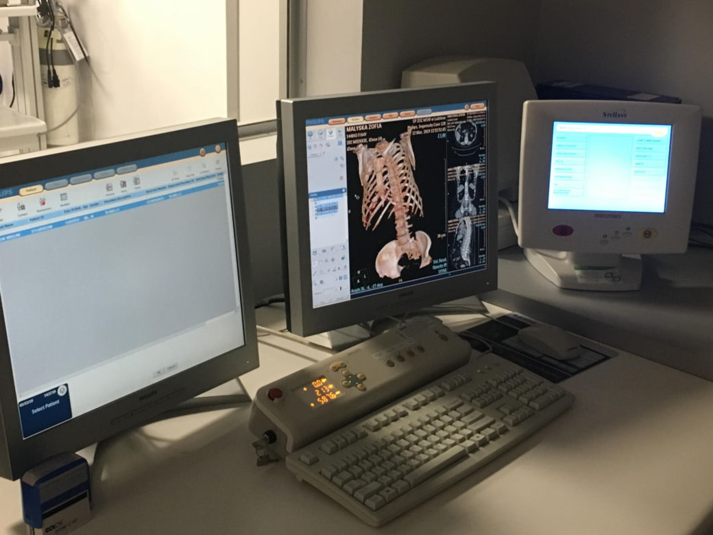 Nowy sprzęt w szpitalu MSWiA w Lublinie. Pomoże zdiagnozować pacjentów