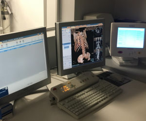 Nowy sprzęt w szpitalu MSWiA w Lublinie. Pomoże zdiagnozować pacjentów