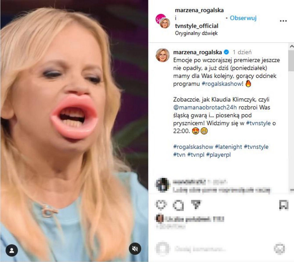 Ogromne usta Marzeny Rogalskiej! Co ona z sobą zrobiła?!