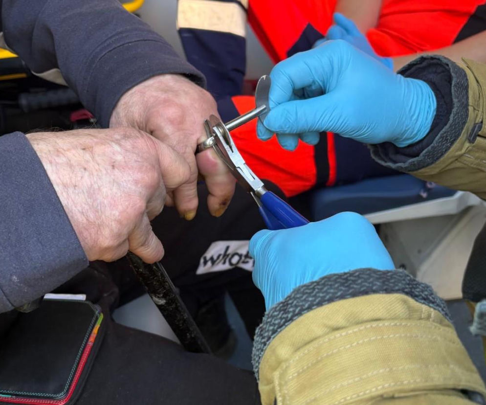 Nietypowa akcja strażaków. Usuwali pierścionek z palca