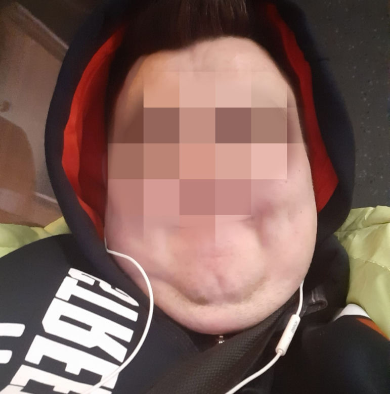 20-letni Michał z Bydgoszczy nie żyje. Był zakażony koronawirusem
