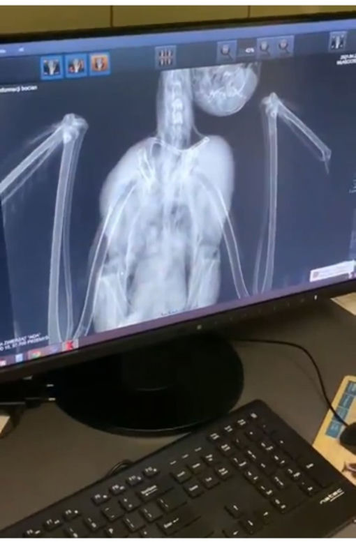Bocian Antek został wypchnięty z gniazda na druty wysokiego napięcia