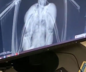 Bocian Antek został wypchnięty z gniazda na druty wysokiego napięcia