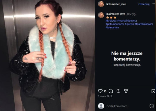 Marta Linkiewicz przed zabiegami 