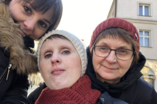 Żyję z fibrodysplazją. Moje ciało staje się żywym posągiem