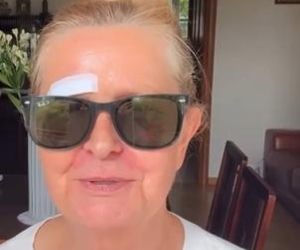 Barbara Busztynowicz miała wypadek! Skończyło się szyciem. Nikt się nie zatrzymał