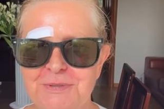 Barbara Busztynowicz miała wypadek! Skończyło się szyciem. Nikt się nie zatrzymał