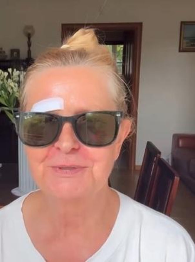 Barbara Busztynowicz miała wypadek! Skończyło się szyciem. "Nikt się nie zatrzymał"
