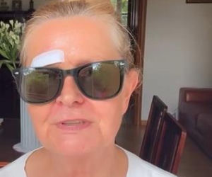 Barbara Busztynowicz miała wypadek! Skończyło się szyciem. Nikt się nie zatrzymał