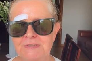 Barbara Busztynowicz miała wypadek! Skończyło się szyciem. Nikt się nie zatrzymał