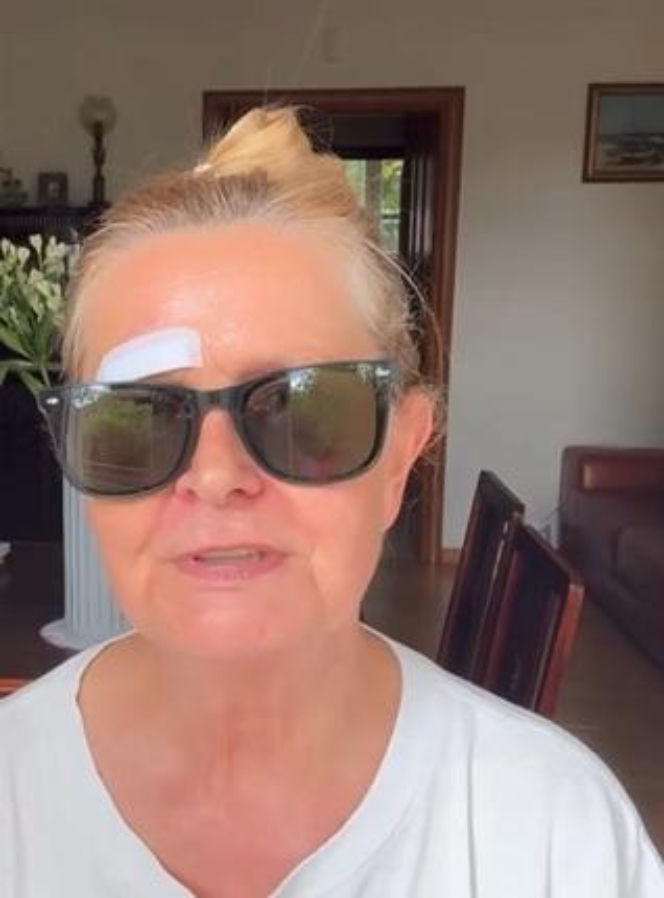 Barbara Busztynowicz miała wypadek! Skończyło się szyciem. "Nikt się nie zatrzymał"