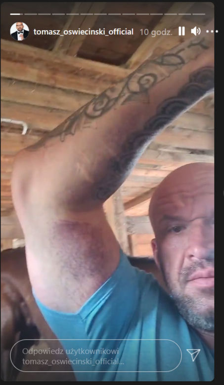 Tomasz Oświeciński (Andrzejek z M jak miłość) na Instagramie opowiada o wypadku i operacji