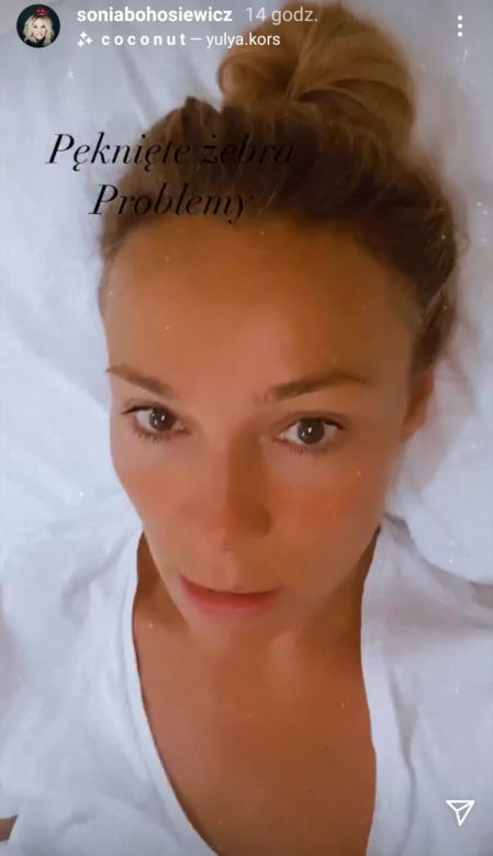 Sonia Bohosiewicz: Spadła ze schodów