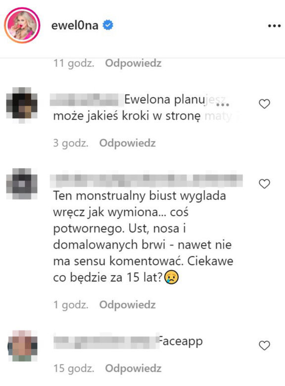 Ewelina z Warsaw Shore przesadziła z operacjami