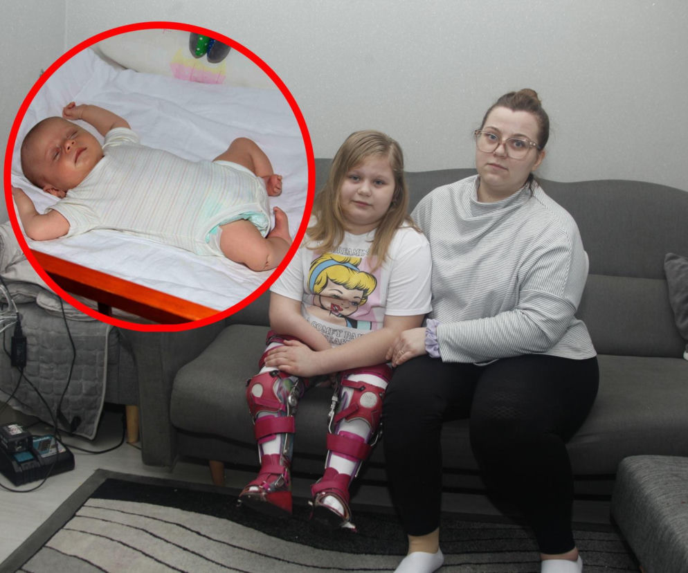 Podarujmy Amelce protezy pod choinkę