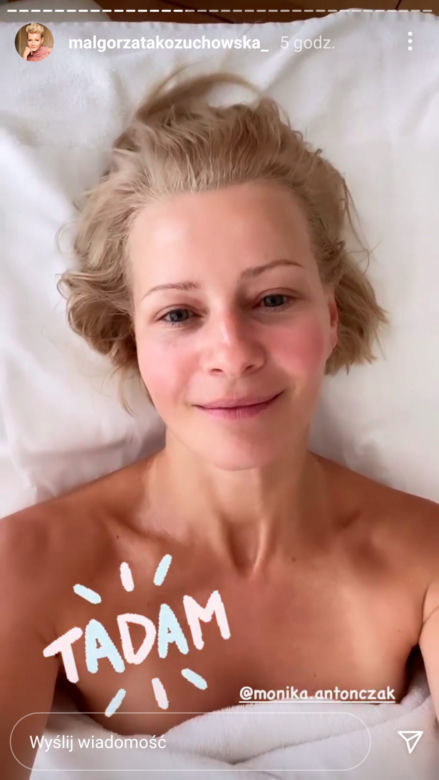 Małgorzata Kożuchowska podniosła policzki i wygładziła czoło