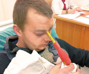 Wyciagneli mu śrubokręt z mózgu