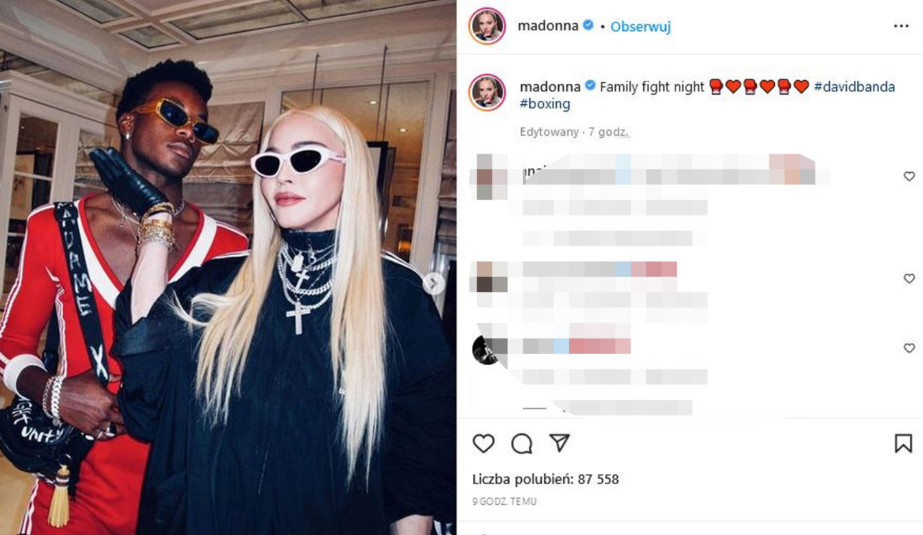  Madonna ma nową twarz! 64-latka przeszła kolejne operacje?