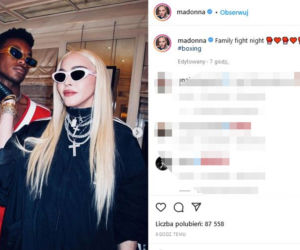  Madonna ma nową twarz! 64-latka przeszła kolejne operacje?