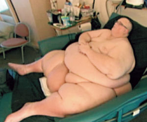 Schudł 273 kg dla miłości